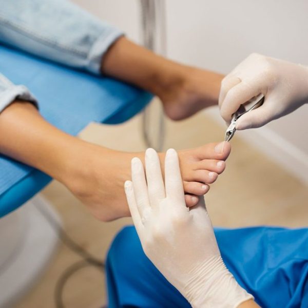 Hiperkeratozy w gabinecie podologicznym